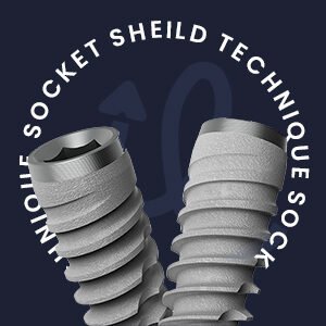 Group logo of The Socket Shield Circle