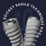 Group logo of The Socket Shield Circle